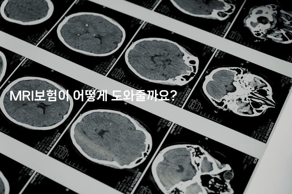 MRI보험이 어떻게 도와줄까요?